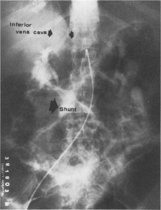 Fig. 10A.