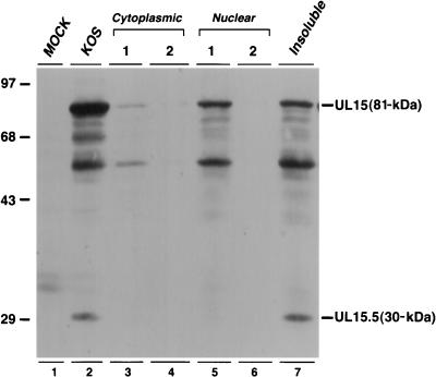 FIG. 1