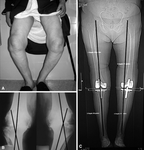 Fig. 1A–C