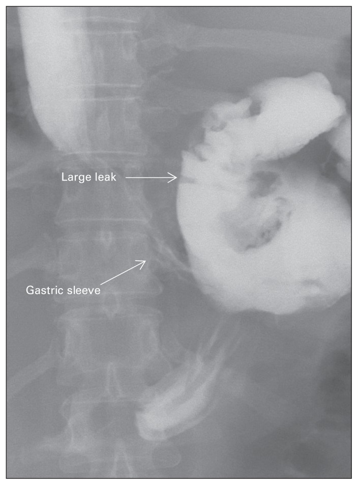 Fig. 3