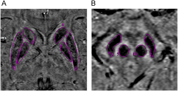 Fig 1