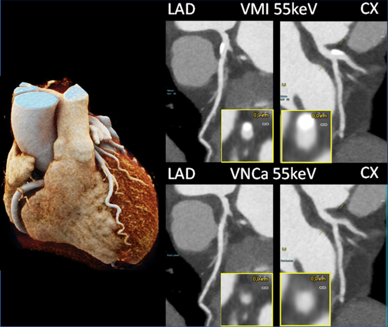 FIGURE 11