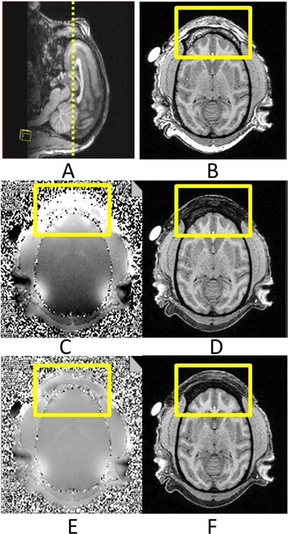 Fig 3.