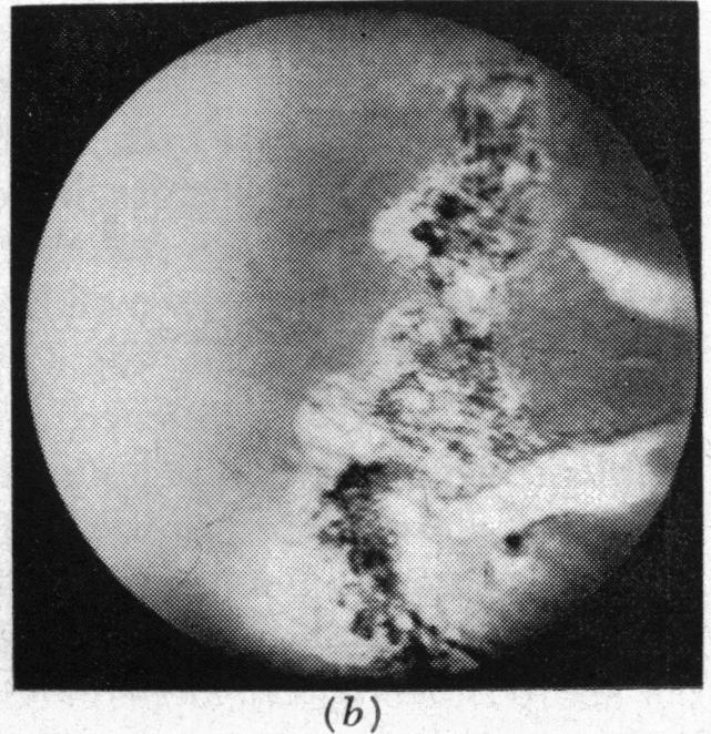 FIGURE 1 (b)