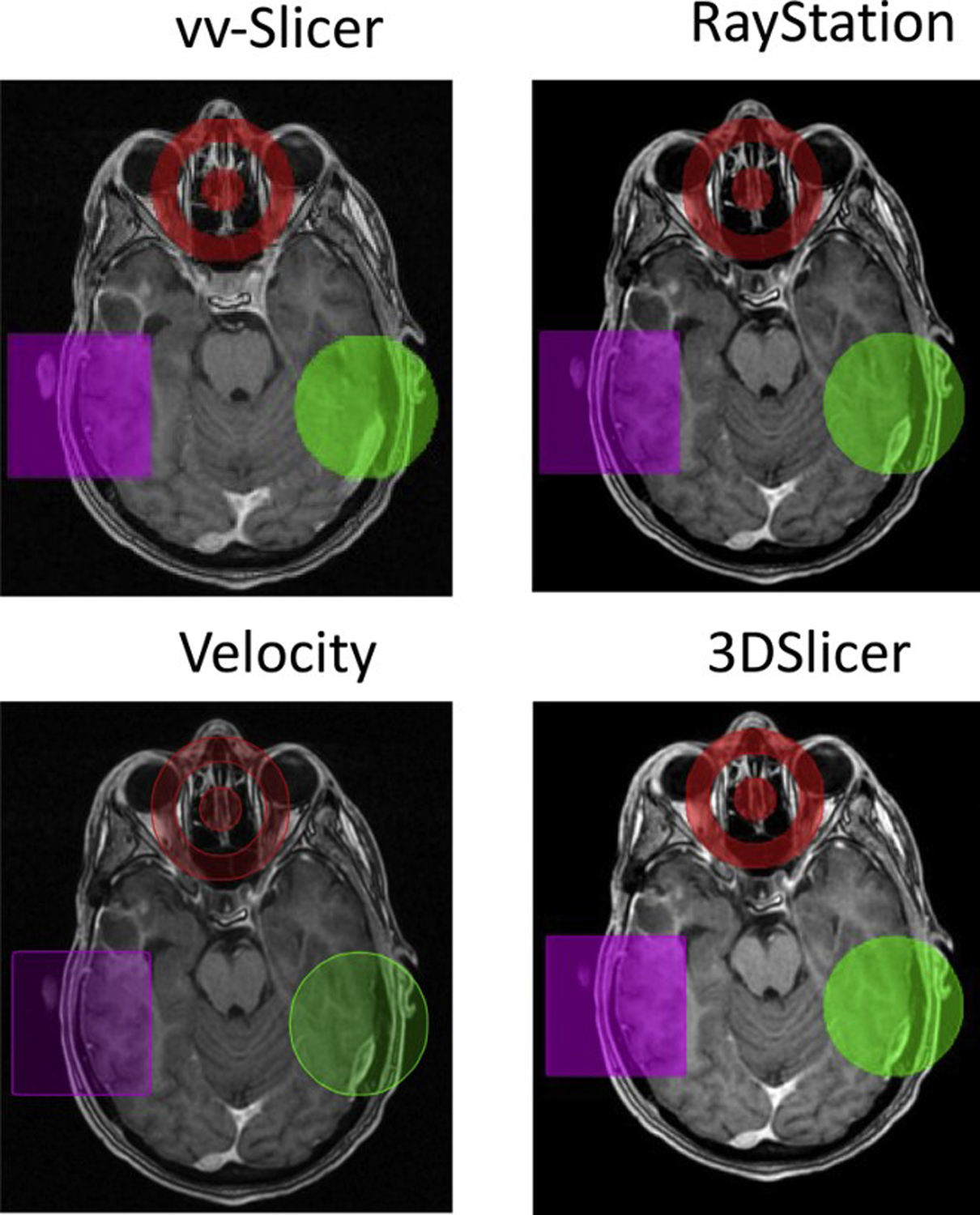 Figure 1: