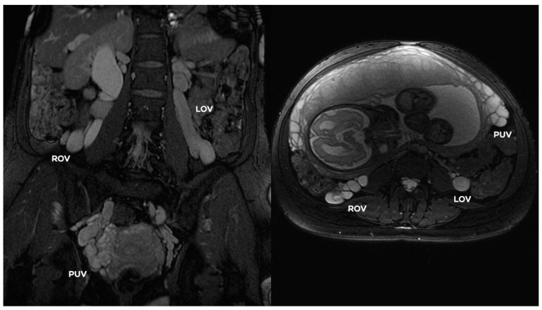 Figure 18