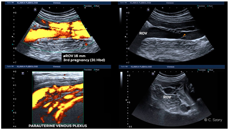 Figure 16