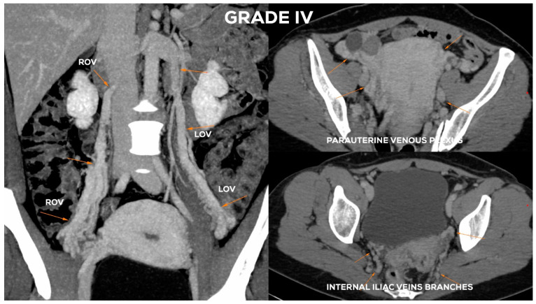 Figure 17