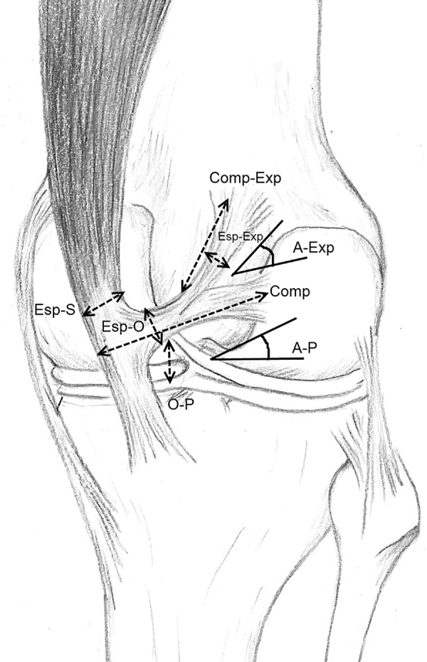 Oblique popliteal ligament – an anatomical study - PMC