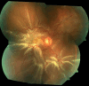 Fig. 3