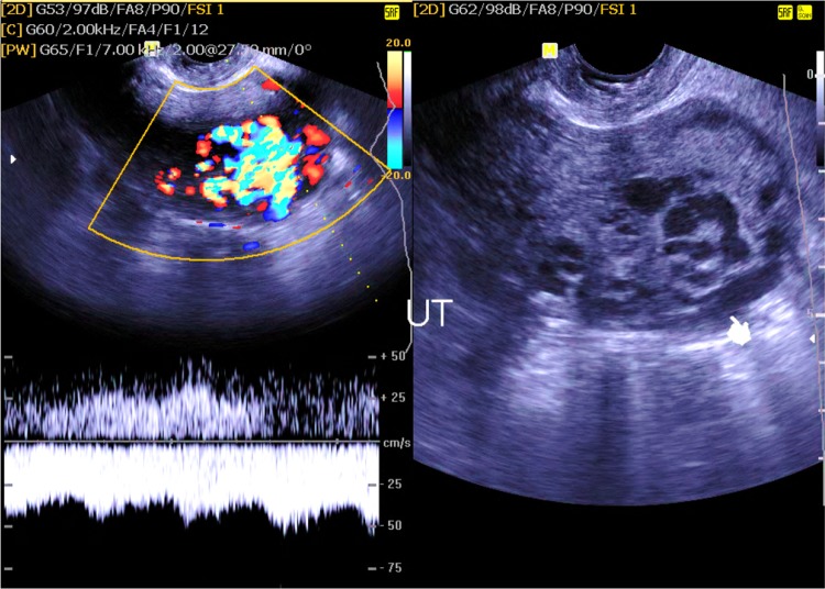 Fig. 11