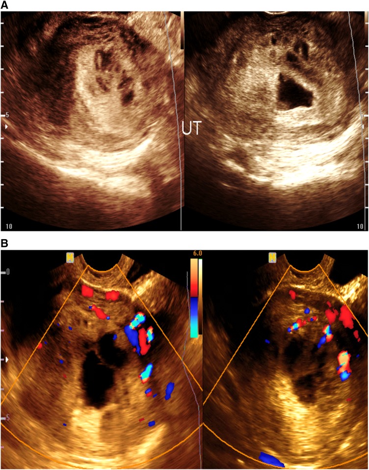 Fig. 10