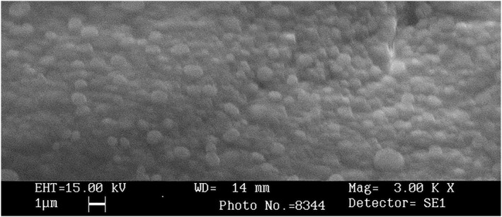 Investigating Preparation And Characterisation Of Diphtheria Toxoid 