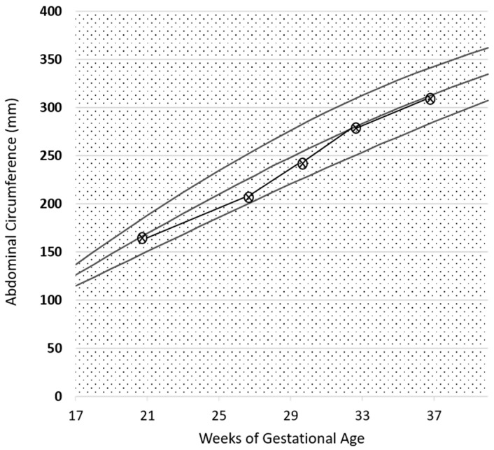 Figure 10