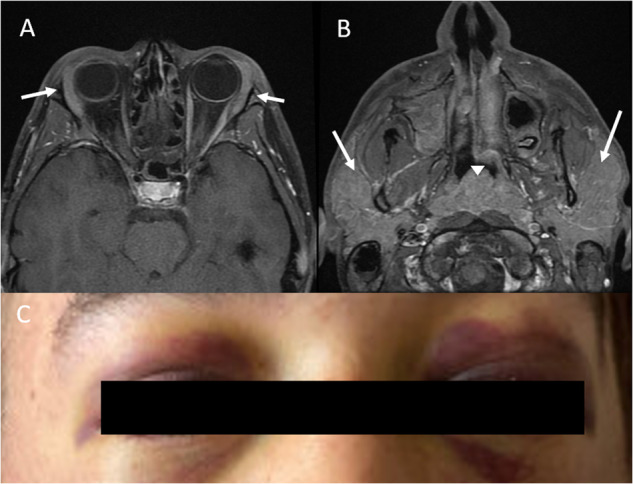 Fig. 6