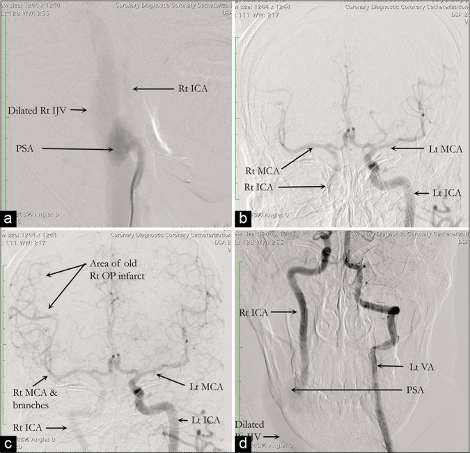 Figure 3: