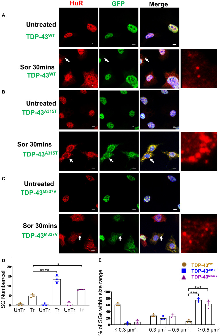 TDP-43 Mutation Affects Stress Granule Dynamics in Differentiated NSC ...