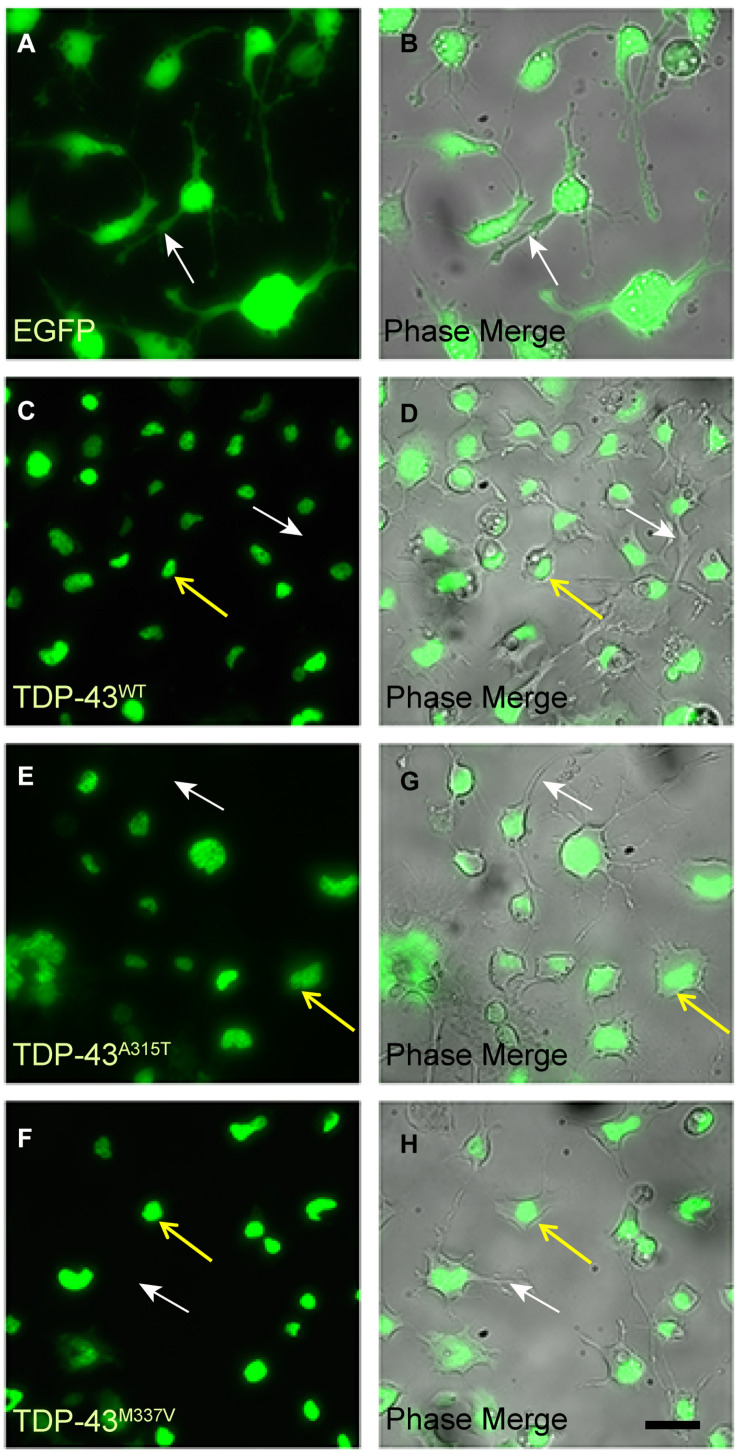 TDP-43 Mutation Affects Stress Granule Dynamics in Differentiated NSC ...