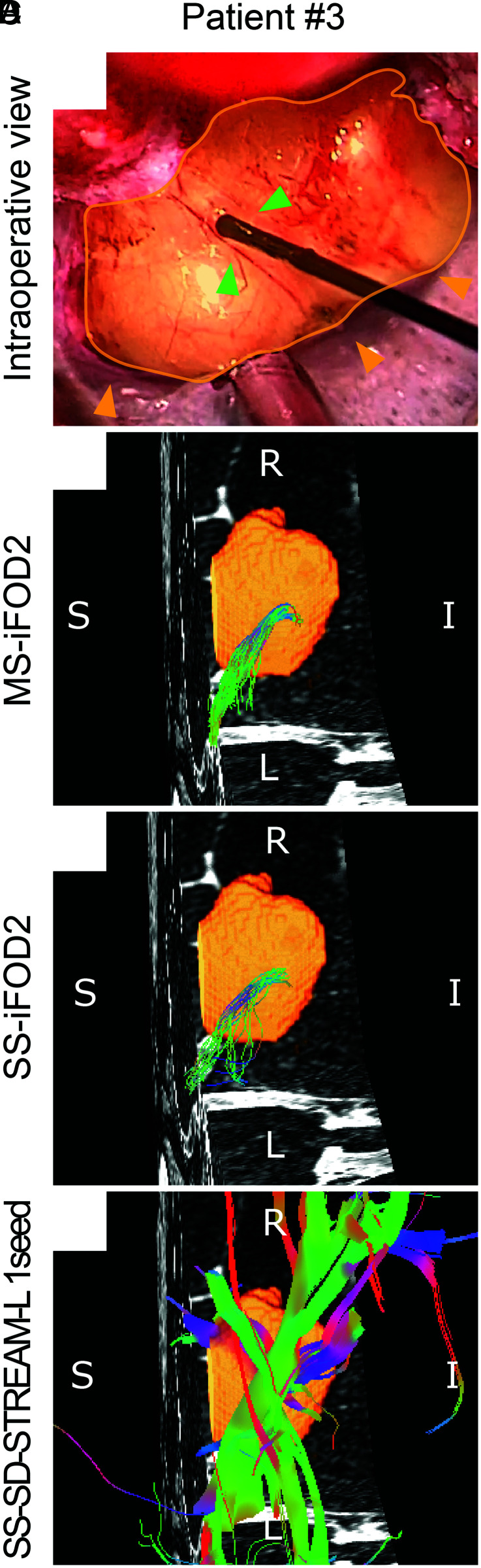 Fig 2.