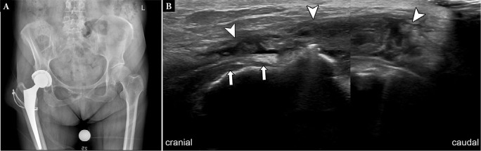 Fig. 16.