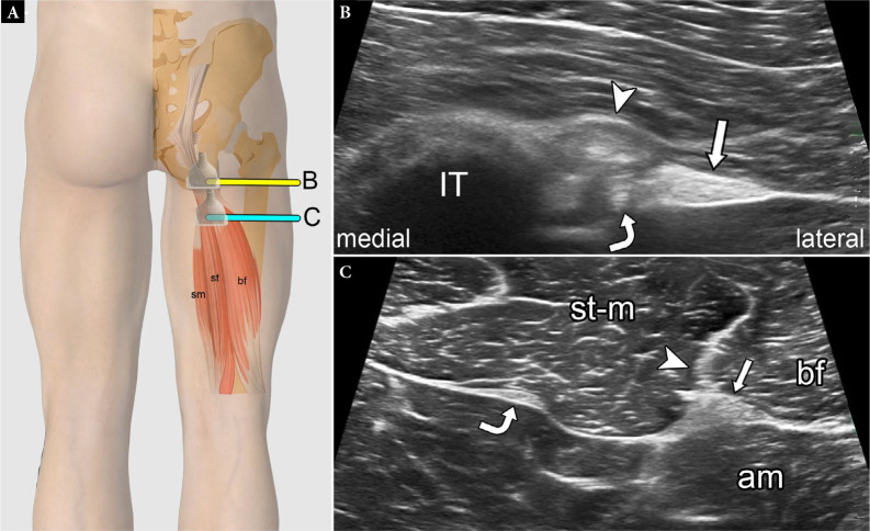 Fig. 20.