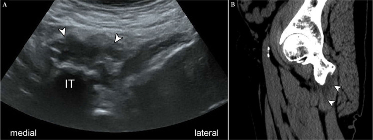 Fig. 23.