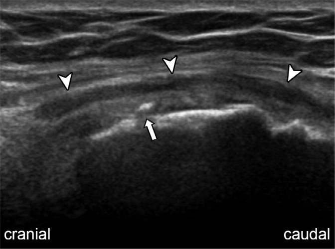 Fig. 13.