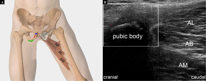 Fig. 24.