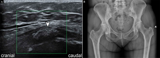 Fig. 14.