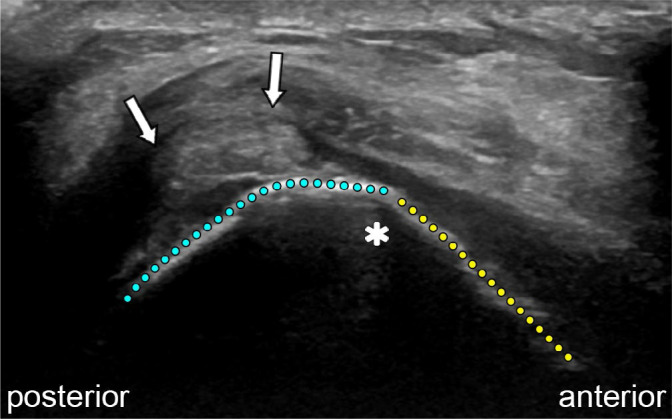 Fig. 15.