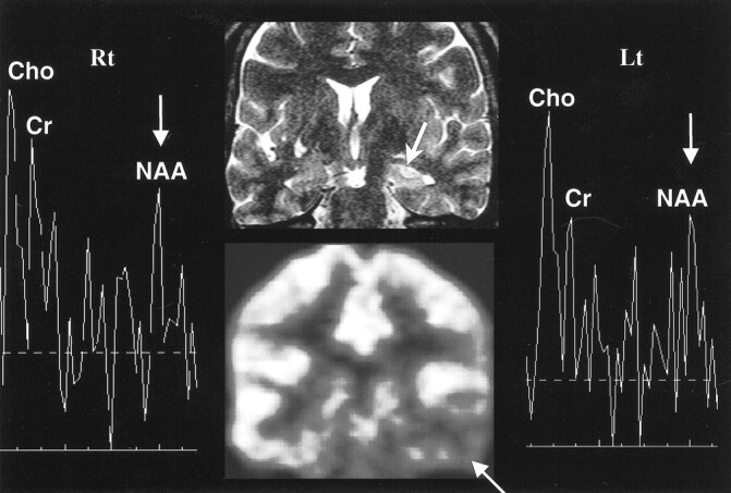 fig 3.