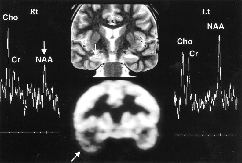 fig 1.