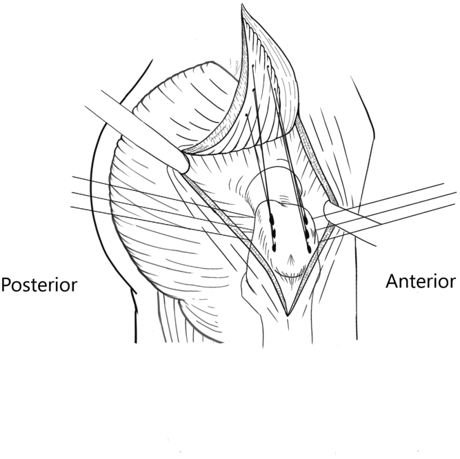 Fig 7