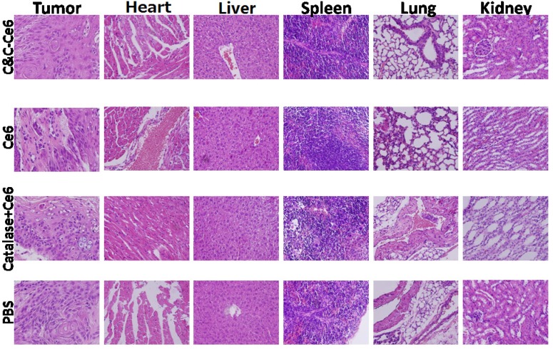 Figure 11