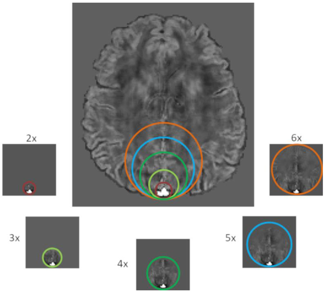 Figure 2: