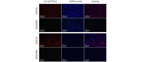 Red fluorescence intensity indicates the abundance of KCTD12, and blue fluorescence indicates the cell nucleus. Scale bars in the up and low panel were 200 μm and 50 μm, respectively.