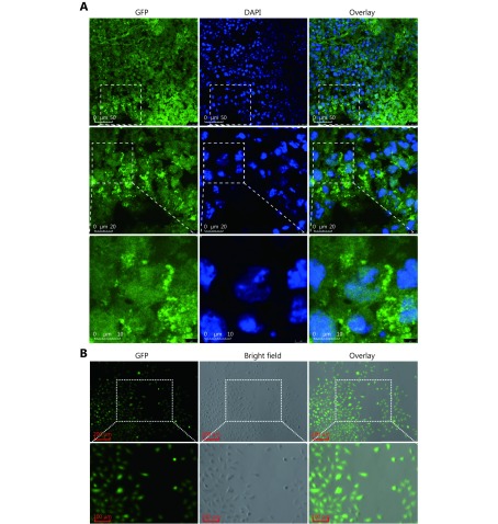 (A) Laser scanning confocal microscope photographs of metastatic tumor sections in lung from BALB/C nude mouse after A375-GFP cells being injected for 2 months through caudal vein. Scale bars in the up, middle and low panel were 50 μm, 20 μm and 10 μm, respectively. (B) Fluorescence microphotography of the established A375M cell line. Scale bars in the up and low panel were 200 μm and 100 μm, respectively.