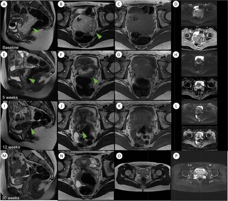 Fig. 4