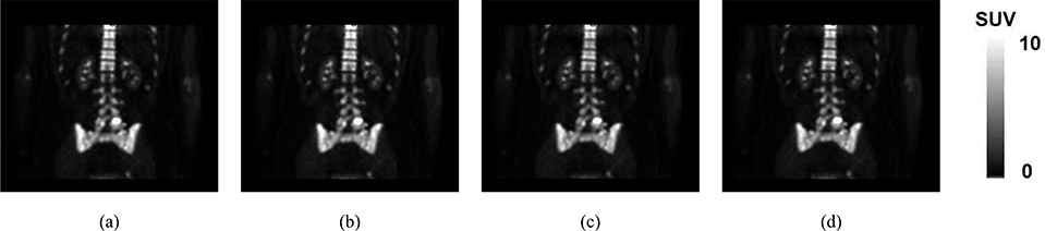 Fig. 11.