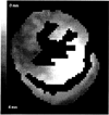 FIG. 6