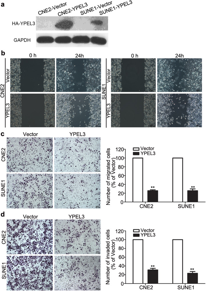 Correction To YPEL3 Suppresses Epithelialmesenchymal Transition And Metastasis Of