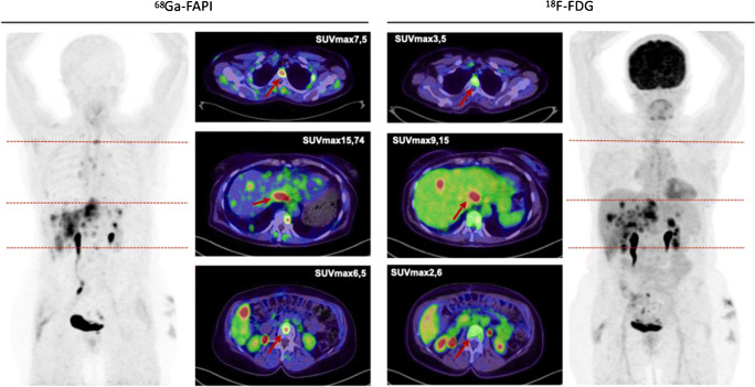 Fig. 6