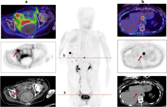 Fig. 10