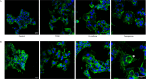 Figure 5 is a staining of A-actin, B-beta-catenin protein localization and nucleus of Michigan Cancer Foundation-7 cells and methylenedioxyamphetamine-M B-231 cells, with a scale bar of 20 micrometers displaying four columns, namely, control, 2,3,7,8-Tetrachlorodibenzo-italic p-dioxin, Co-culture, and Coexposure and two rows, namely A and B.