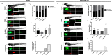 Figure 6A is a measurement of metastatic spread of Michigan Cancer Foundation-7 cells and methylenedioxyamphetamine-M B-231 in zebrafish larvae in vivo models depicting Human red fluorescent protein in Michigan Cancer Foundation-7 cells and methylenedioxyamphetamine-M B-231 cells for Control, 2,3,7,8-Tetrachlorodibenzo-p-dioxin, co-culture, and co-exposure (co-culture with 2,3,7,8-Tetrachlorodibenzo-italic p-dioxin). Figure 6B in Michigan Cancer Foundation-7 and methylenedioxyamphetamine-M B-231 is a set of one stacked bar graph (a) and two bar graphs (b and c). Figure 6B (a) is a stacked bar graph plotting Percentage of embryos, ranging from 0 to 100 in increments of 50 (y-axis) across control, 2,3,7,8-Tetrachlorodibenzo-p-dioxin, Co-culture, and Co-exposure (x-axis) for metastasis and no metastasis, respectively. Figure 6B (b and c) are bar graphs plotting Metastases or Fish, ranging from 0 to 40 in increments of 10 and 0 to 30 in increments of 10; Percentage of fish with head metastasis, ranging from 0 to 30 in increments of 10 and 0 to 100 in increments of 20 (y-axis) across control, 2,3,7,8-Tetrachlorodibenzo-italic p-dioxin, Co-culture, and Co-exposure (x-axis), respectively.