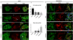 Figures 4A and 4C are staining of Michigan Cancer Foundation-7 cells and methylenedioxyamphetamine-M B-231 cells following exposure to 2,3,7,8-Tetrachlorodibenzo-italic p-dioxin, co-culture or coexposure with scale bar of 20 micrometers displaying three columns, namely, Actin, Paxillin, and Merge and four rows, namely, control, 2,3,7,8-Tetrachlorodibenzo-italic p-dioxin, Co-culture, and Coexposure. Figure 4B is a set of two bar graphs titled Cell number per field and Giant cells per field plotting Quantitation, ranging from 0 to 150 in increments of 50 and 0 to 5 in unit increments (y-axis) across control, 2,3,7,8-Tetrachlorodibenzo-italic p-dioxin, Co-culture, and Coexposure (x-axis), respectively.