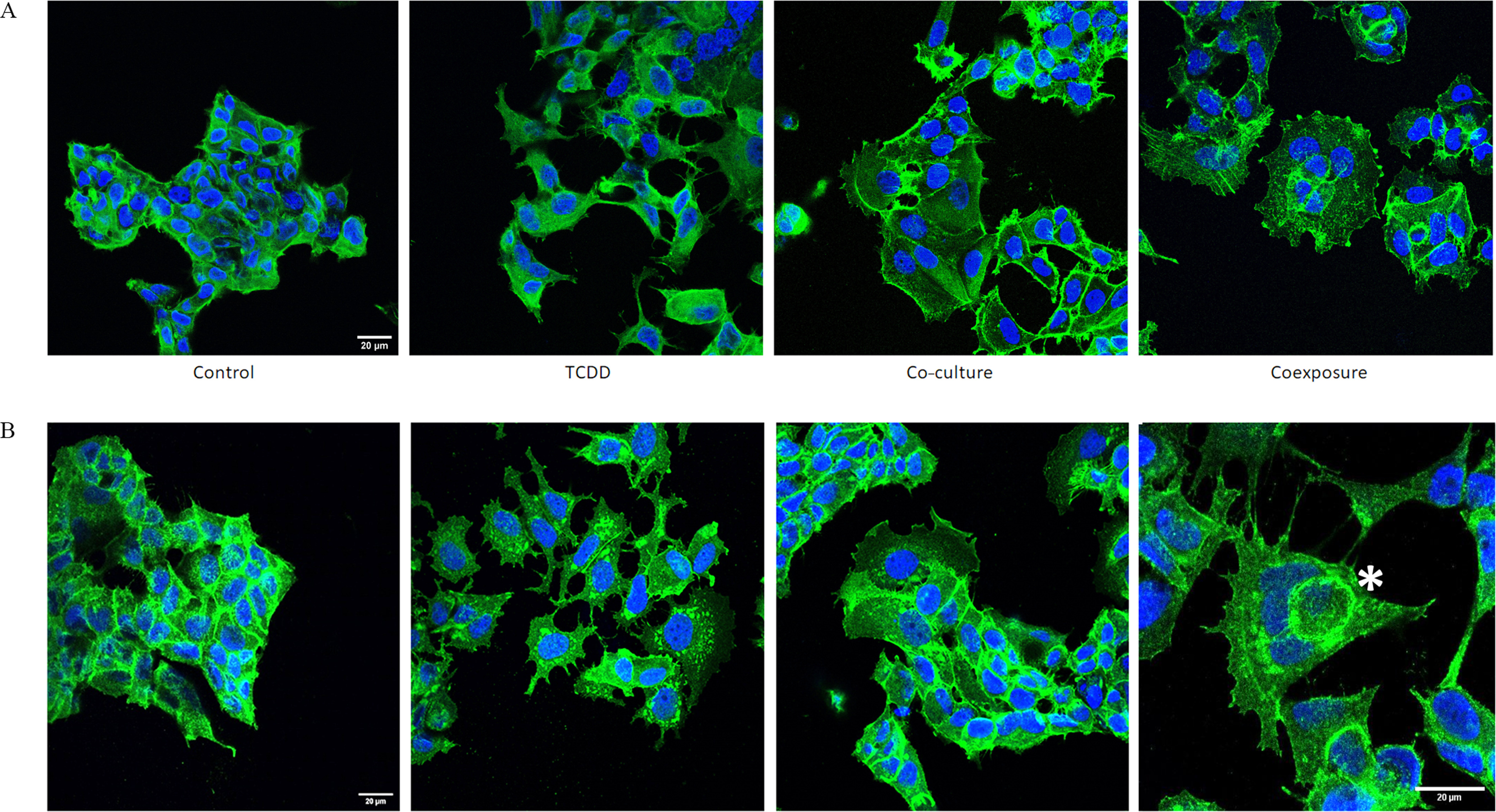 Figure 5 is a staining of A-actin, B-beta-catenin protein localization and nucleus of Michigan Cancer Foundation-7 cells and methylenedioxyamphetamine-M B-231 cells, with a scale bar of 20 micrometers displaying four columns, namely, control, 2,3,7,8-Tetrachlorodibenzo-italic p-dioxin, Co-culture, and Coexposure and two rows, namely A and B.