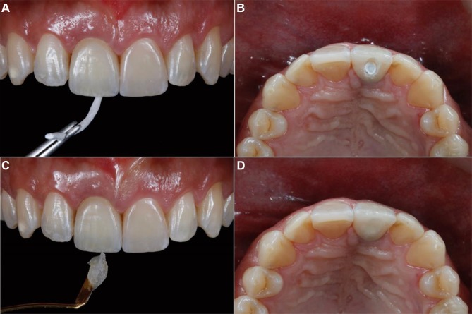 Figure 11