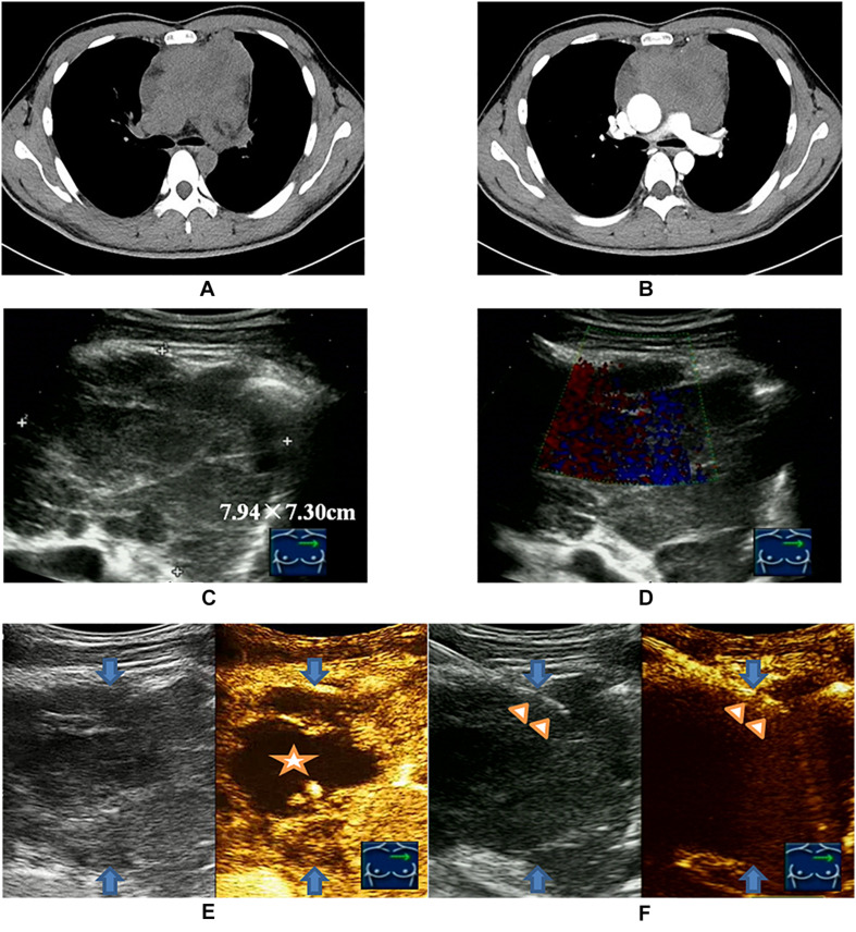 FIGURE 3