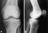 Fig. 1A–B